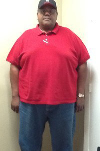 Medical Weight Loss Webster TX Reese Before